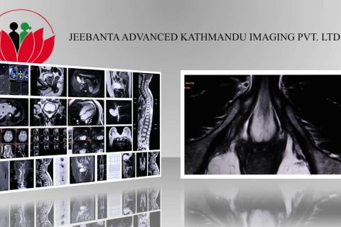 First time in Nepal, JEEBANTA introduced the ultra advanced 3 Tesla MRI (VIDEO)